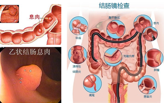 經(jīng)常放屁是在“排毒”？或許“根源”在腸道！